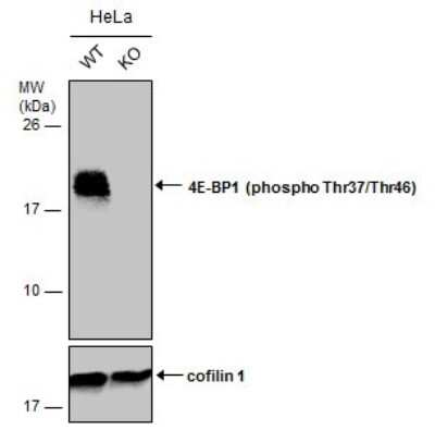 Western Blot: 4EBP1 [p Thr46, p Thr37] Antibody [NBP3-13169]